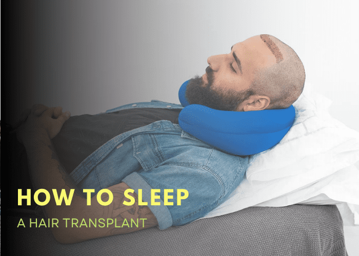 How To Sleep After A Hair Transplant